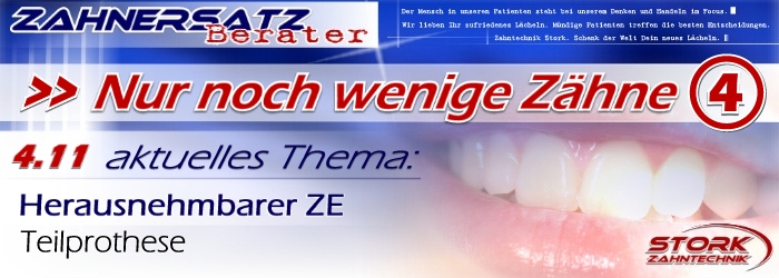 Nur noch wenige Zähne